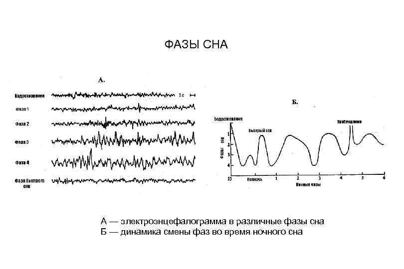 Ээг сна. ЭЭГ-корреляты фаз сна.. Фазы сна график по времени. Схема стадий сна по данным ЭЭГ. Фазы сна по времени.