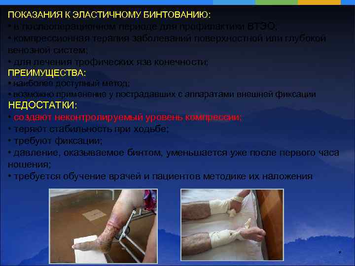 ПОКАЗАНИЯ К ЭЛАСТИЧНОМУ БИНТОВАНИЮ: • в послеоперационном периоде для профилактики ВТЭО; • компрессионная терапия