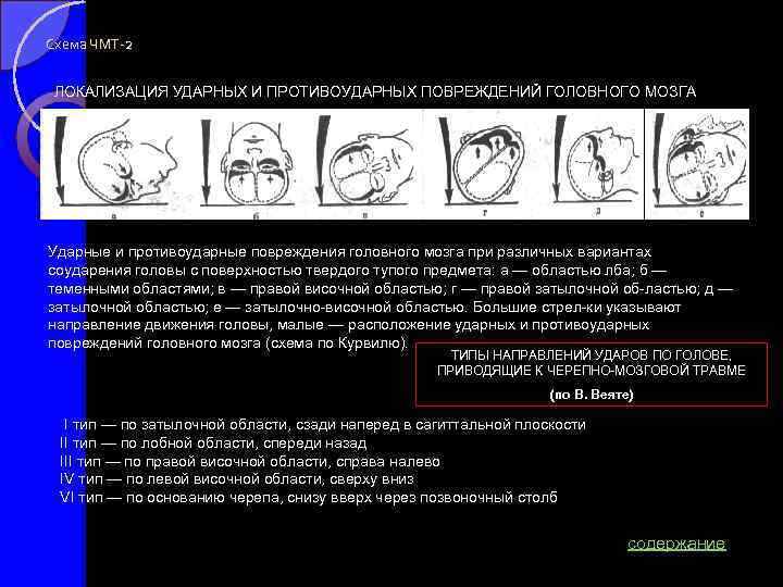Схема ЧМТ-2 ЛОКАЛИЗАЦИЯ УДАРНЫХ И ПРОТИВОУДАРНЫХ ПОВРЕЖДЕНИЙ ГОЛОВНОГО МОЗГА Ударные и противоударные повреждения головного