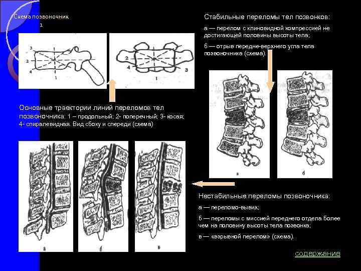 Компрессионный перелом карта вызова