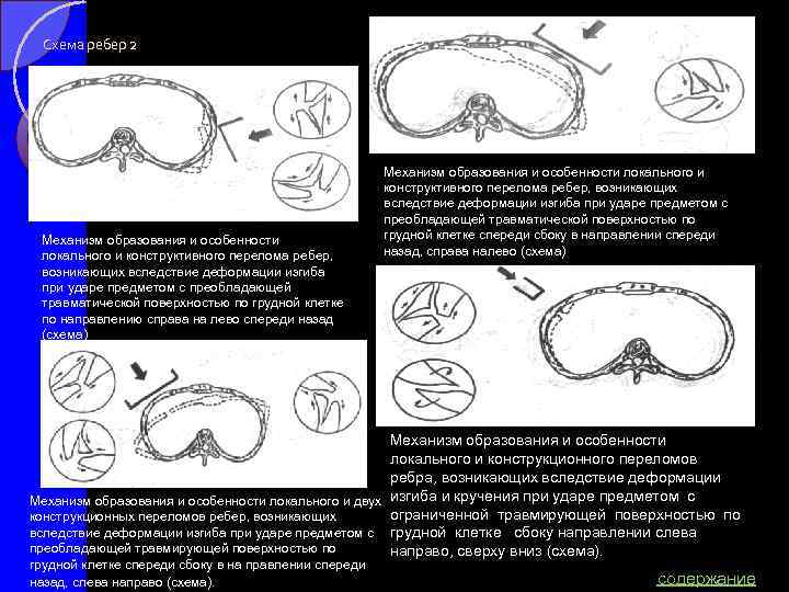 Ромодановский судебная медицина в схемах и рисунках