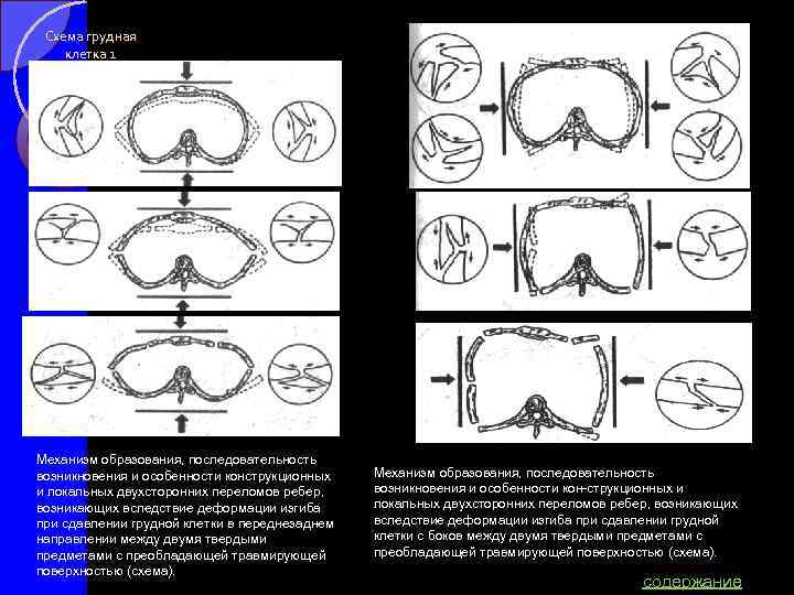 Схема грудная клетка 1 Механизм образования, последовательность возникновения и особенности конструкционных и локальных двухсторонних
