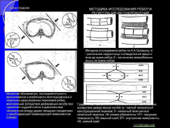 Схема грудная клетка 2 МЕТОДИКА ИССЛЕДОВАНИЯ РЕБЕР И РЕГИСТРАЦИЯ ИХ ПОВРЕЖДЕНИЙ Методика исследования ребер