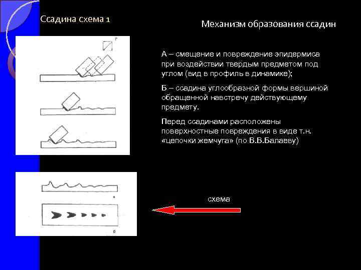 Схема описания повреждений судебная медицина