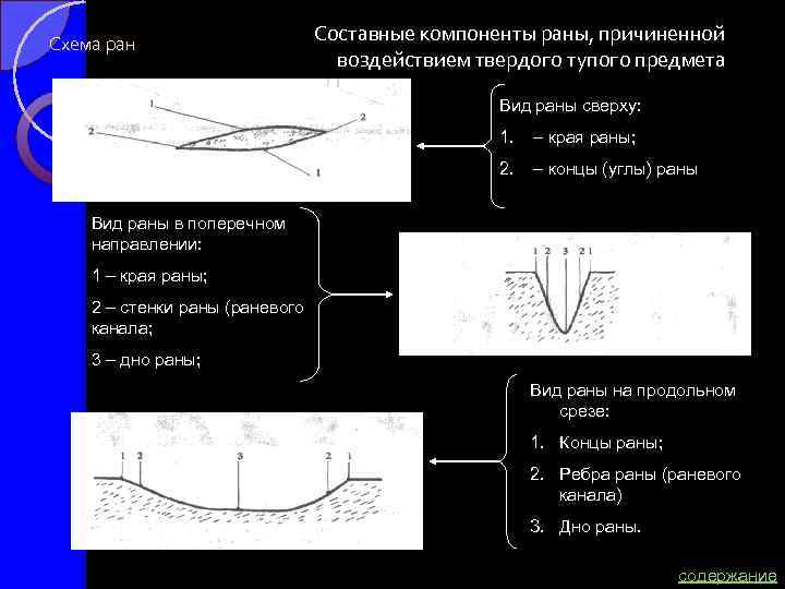 Схема ран Составные компоненты раны, причиненной воздействием твердого тупого предмета Вид раны сверху: 1.