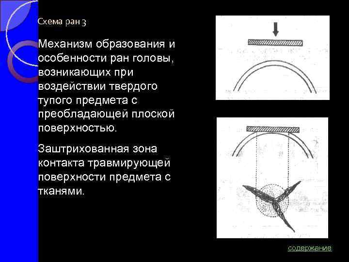 Схема ран 3 Механизм образования и особенности ран головы, возникающих при воздействии твердого тупого