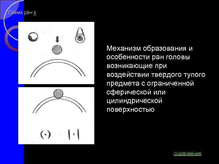 Схема ран 5 Механизм образования и особенности ран головы возникающие при воздействии твердого тупого