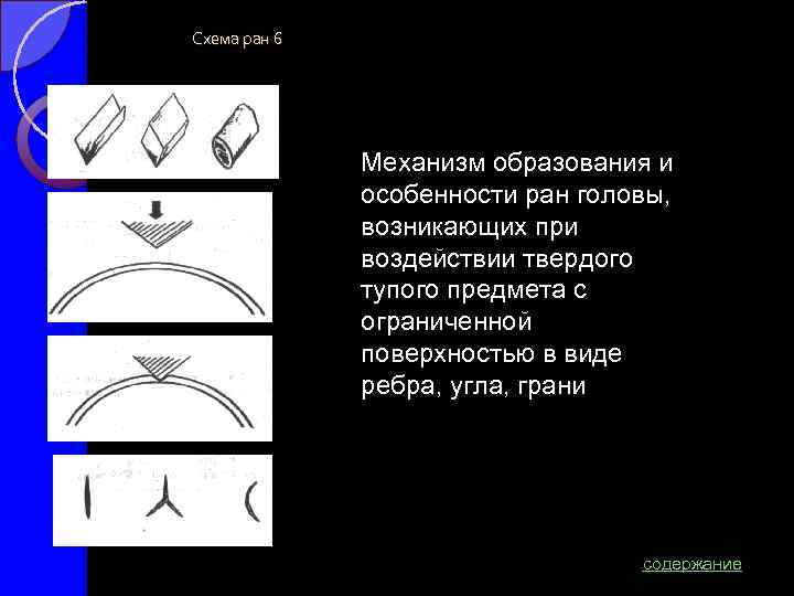 Схема ран 6 Механизм образования и особенности ран головы, возникающих при воздействии твердого тупого
