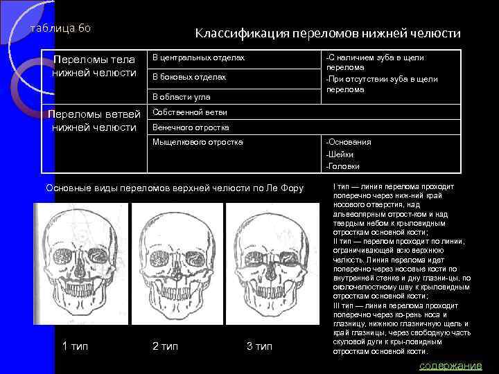таблица 60 Переломы тела нижней челюсти Классификация переломов нижней челюсти В центральных отделах С