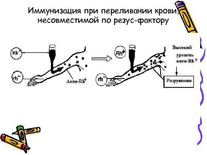 Иммунизация при переливании крови, несовместимой по резус-фактору 