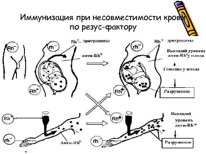 Иммунизация при несовместимости крови по резус-фактору 