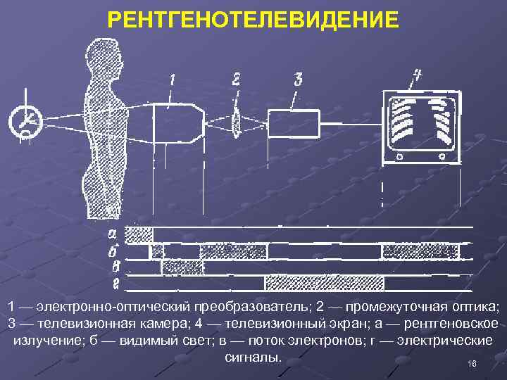 РЕНТГЕНОТЕЛЕВИДЕНИЕ 1 — электронно-оптический преобразователь; 2 — промежуточная оптика; 3 — телевизионная камера; 4