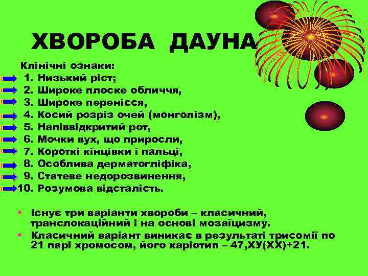 ХВОРОБА ДАУНА Клінічні ознаки: 1. Низький ріст; 2. Широке плоске обличчя, 3. Широке перенісся,