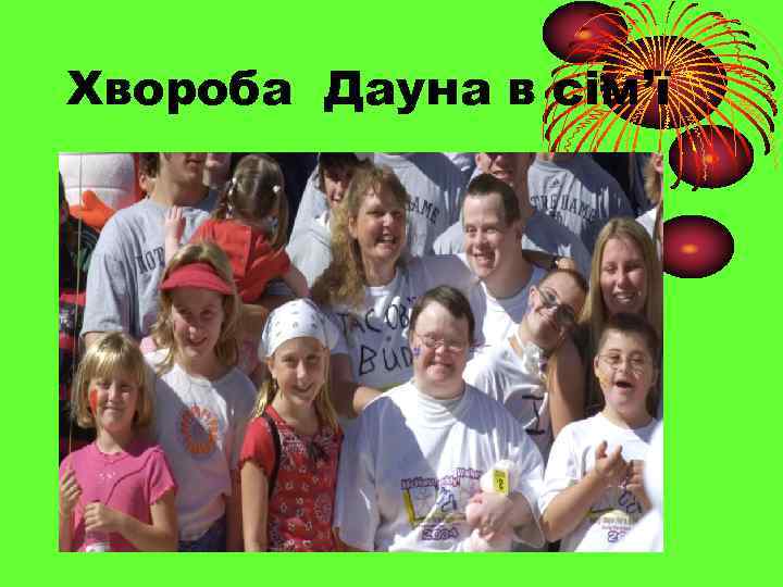 Хвороба Дауна в сім’ї 
