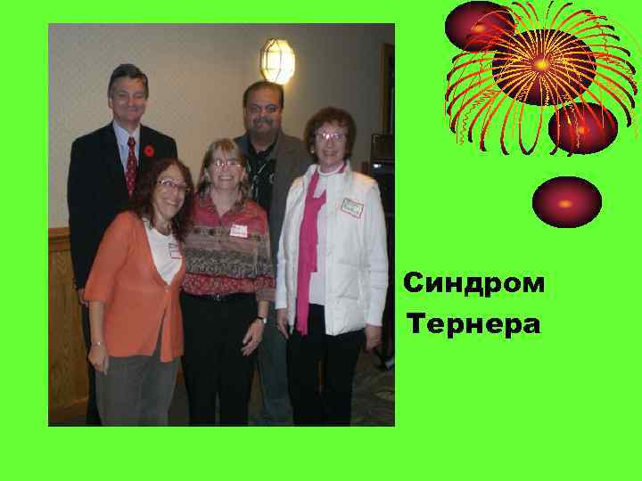  • Синдром Тернера 