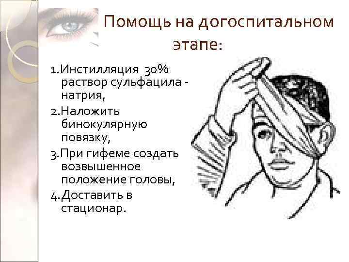 Помощь на догоспитальном этапе: 1. Инстилляция 30% раствор сульфацила натрия, 2. Наложить бинокулярную повязку,