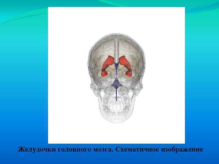 Желудочки головного мозга. Схематичное изображение 