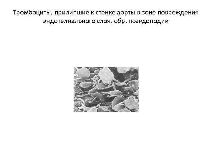 Адгезию тромбоцитов к сосудистой стенке обеспечивает