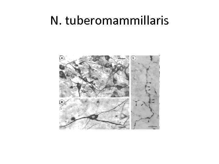 N. tuberomammillaris 