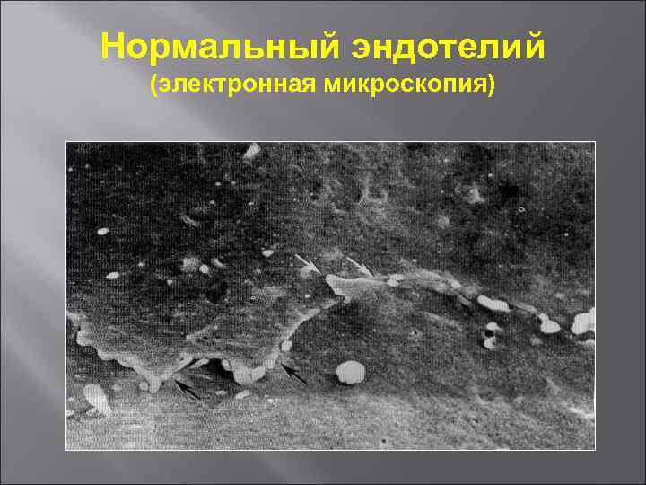 Нормальный эндотелий (электронная микроскопия) 