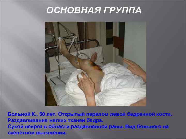 ОСНОВНАЯ ГРУППА Больной К. , 50 лет. Открытый перелом левой бедренной кости. Раздавливание мягких