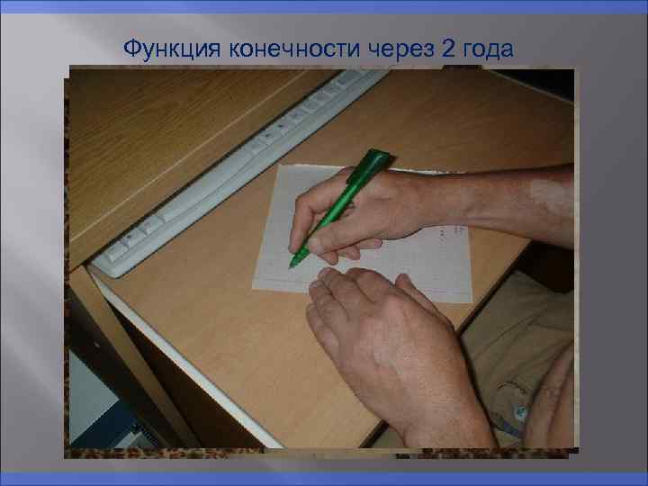 Функция конечности через 2 года 