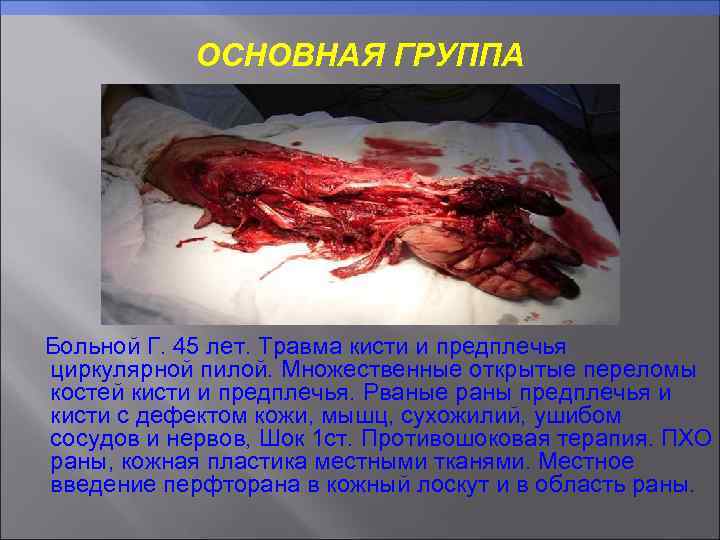 ОСНОВНАЯ ГРУППА Больной Г. 45 лет. Травма кисти и предплечья циркулярной пилой. Множественные открытые