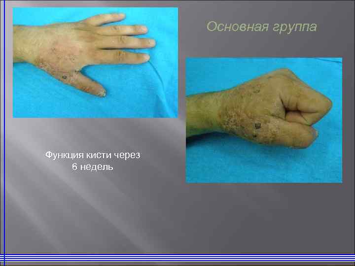 Основная группа Функция кисти через 6 недель 