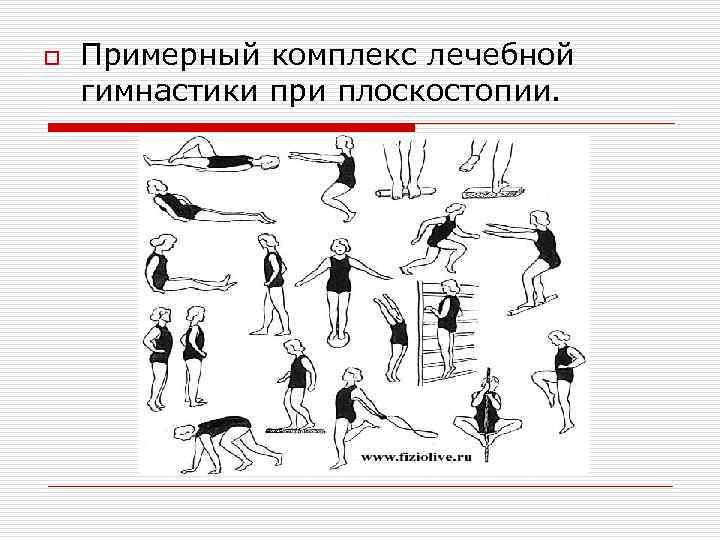 o Примерный комплекс лечебной гимнастики при плоскостопии. 