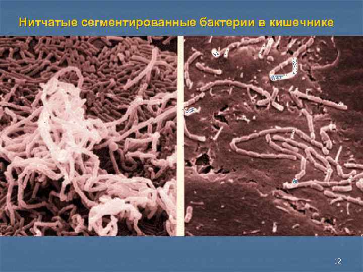 Нитчатые сегментированные бактерии в кишечнике 12 