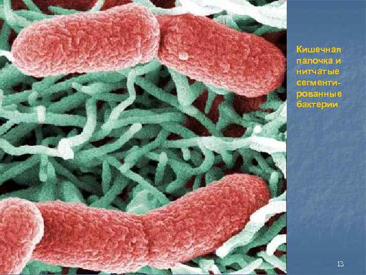 Кишечная палочка и нитчатые сегменти рованные бактерии 13 