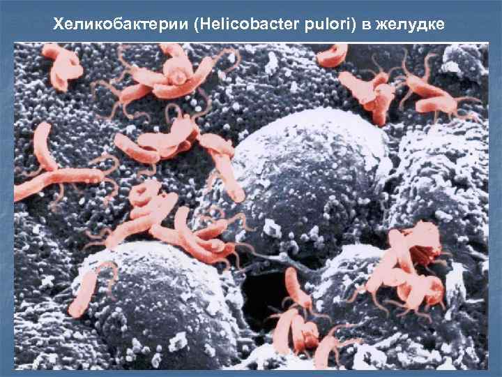 Хеликобактерии (Helicobacter pulori) в желудке 15 