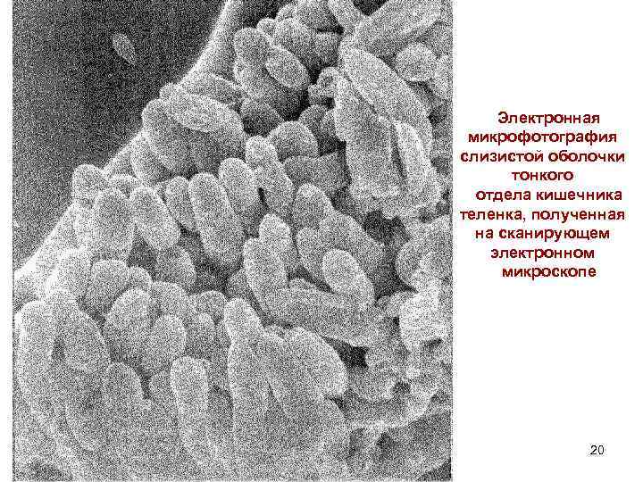 Электронная микрофотография слизистой оболочки тонкого отдела кишечника теленка, полученная на сканирующем электронном микроскопе 20