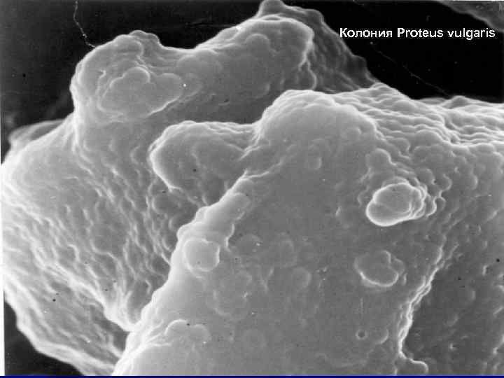 Колония Proteus vulgaris 44 