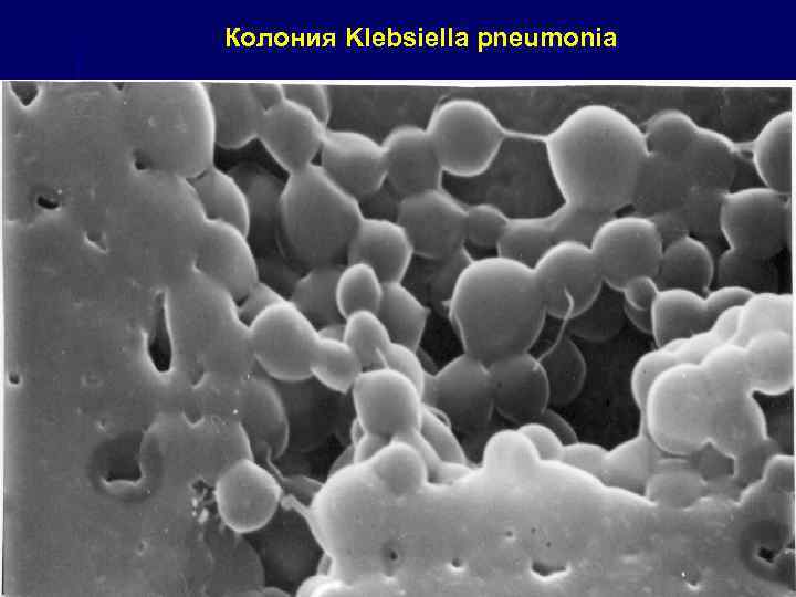 Колония Klebsiella pneumonia 45 
