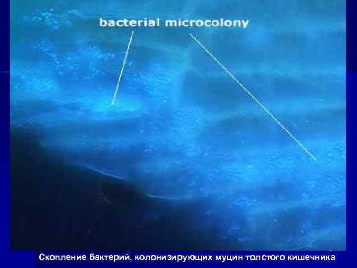46 Скопление бактерий, колонизирующих муцин толстого кишечника 