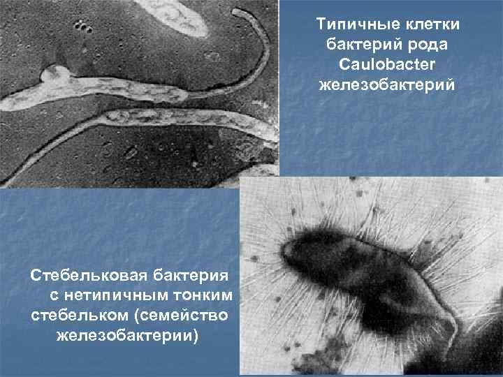 Типичные клетки бактерий рода Caulobacter железобактерий Стебельковая бактерия с нетипичным тонким стебельком (семейство железобактерии).