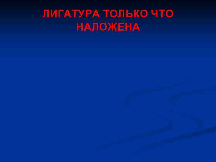 ЛИГАТУРА ТОЛЬКО ЧТО НАЛОЖЕНА 