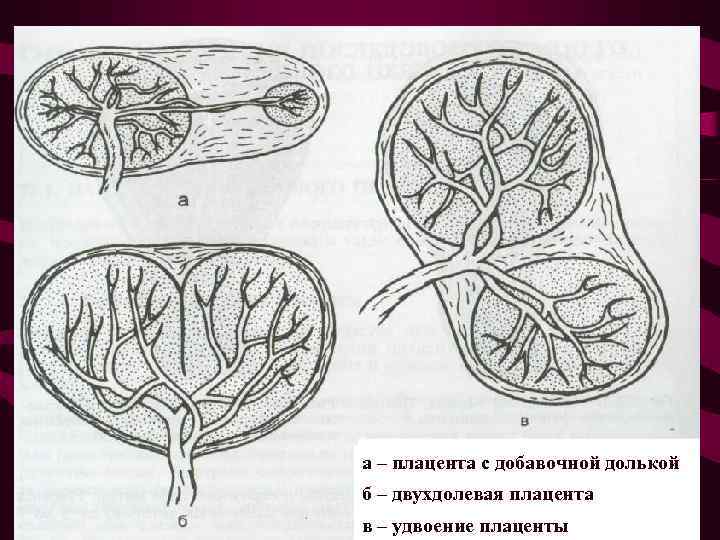 Рисунок матка сосуды плода