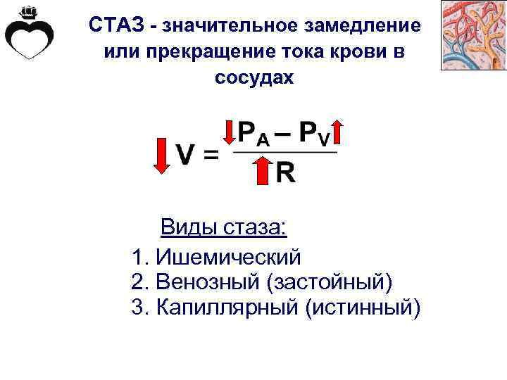 СТАЗ - значительное замедление или прекращение тока крови в сосудах Виды стаза: 1. Ишемический