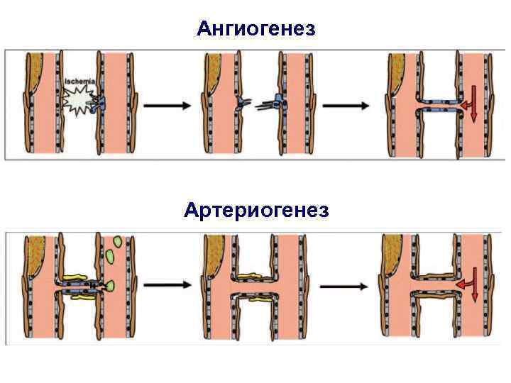 Ангиогенез Артериогенез 