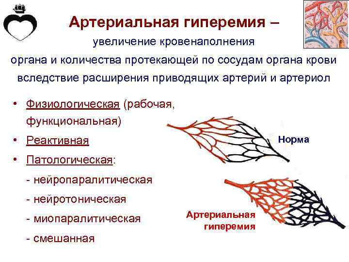 Нарисовать признаки артериальной гиперемии