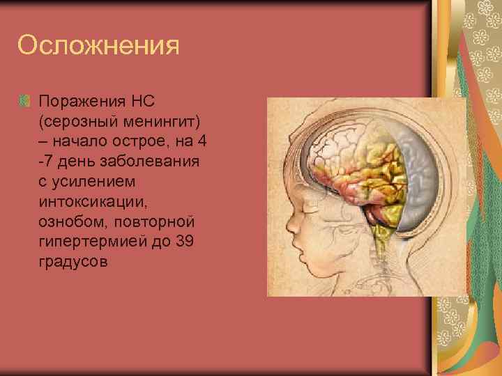 Осложнения Поражения НС (серозный менингит) – начало острое, на 4 -7 день заболевания с