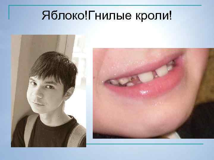 Яблоко!Гнилые кроли! 