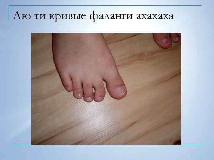 Лю ти кривые фаланги ахахаха 