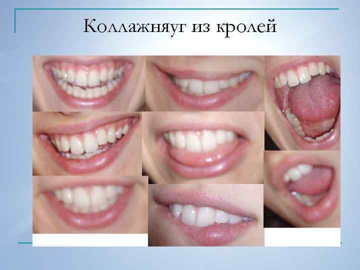 Коллажняуг из кролей 