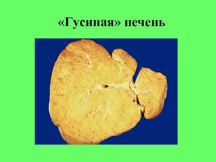  «Гусиная» печень 