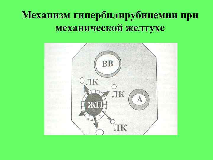 Механизм гипербилирубинемии при механической желтухе 