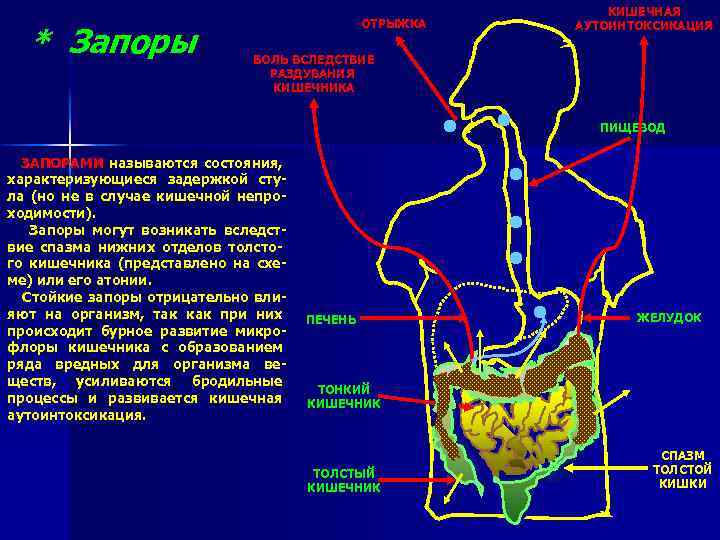 * Запоры ОТРЫЖКА КИШЕЧНАЯ АУТОИНТОКСИКАЦИЯ БОЛЬ ВСЛЕДСТВИЕ РАЗДУВАНИЯ КИШЕЧНИКА ПИЩЕВОД ЗАПОРАМИ называются состояния, характеризующиеся