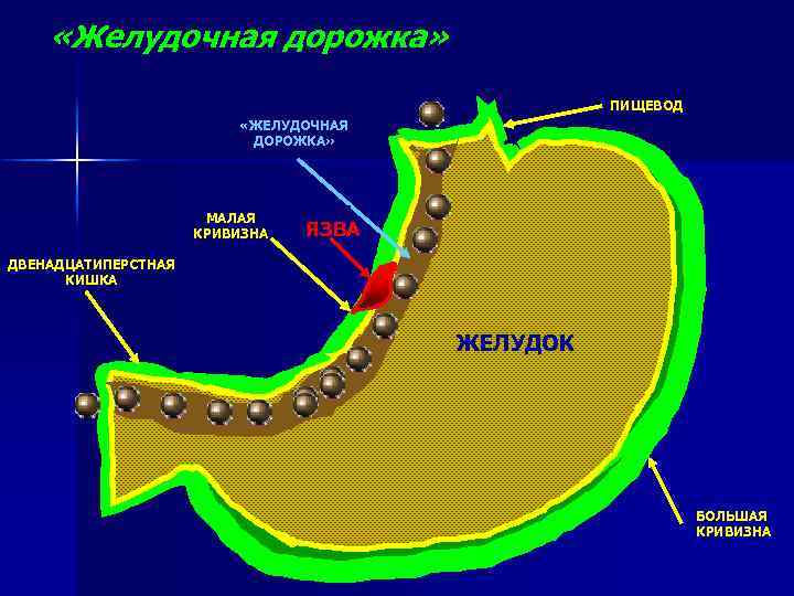  «Желудочная дорожка» ПИЩЕВОД «ЖЕЛУДОЧНАЯ ДОРОЖКА» МАЛАЯ КРИВИЗНА ТРАВМА ЯЗВА ДВЕНАДЦАТИПЕРСТНАЯ КИШКА ЖЕЛУДОК БОЛЬШАЯ